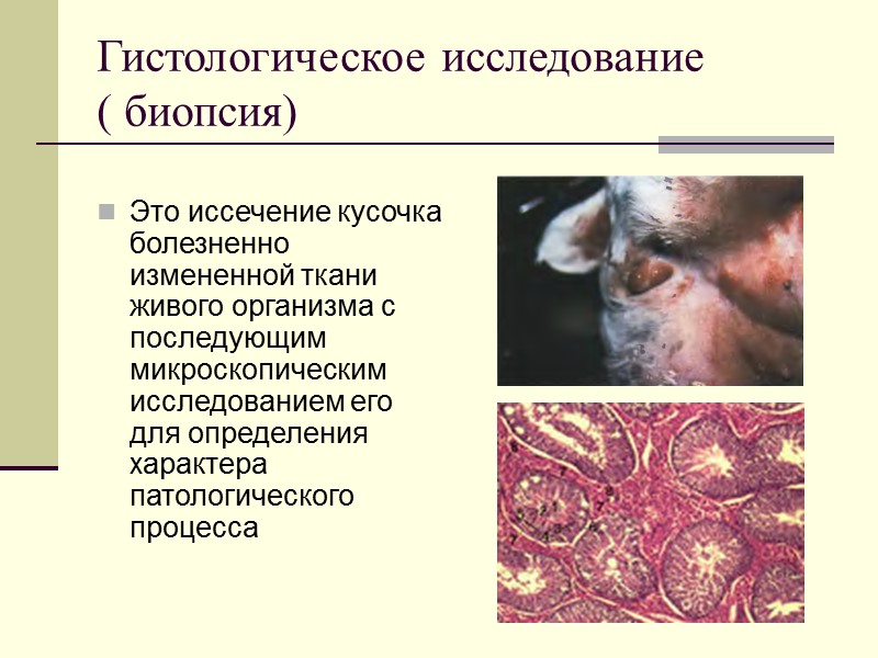 Гистологическое исследование ( биопсия)  Это иссечение кусочка болезненно измененной ткани живого организма с